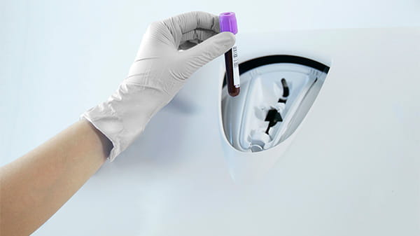 免疫測定装置 AQT90 FLEX 